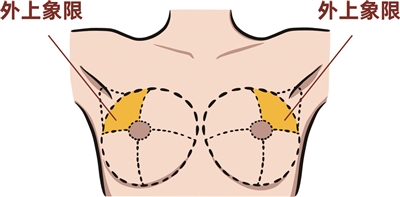 乳房四个象限的划分图图片